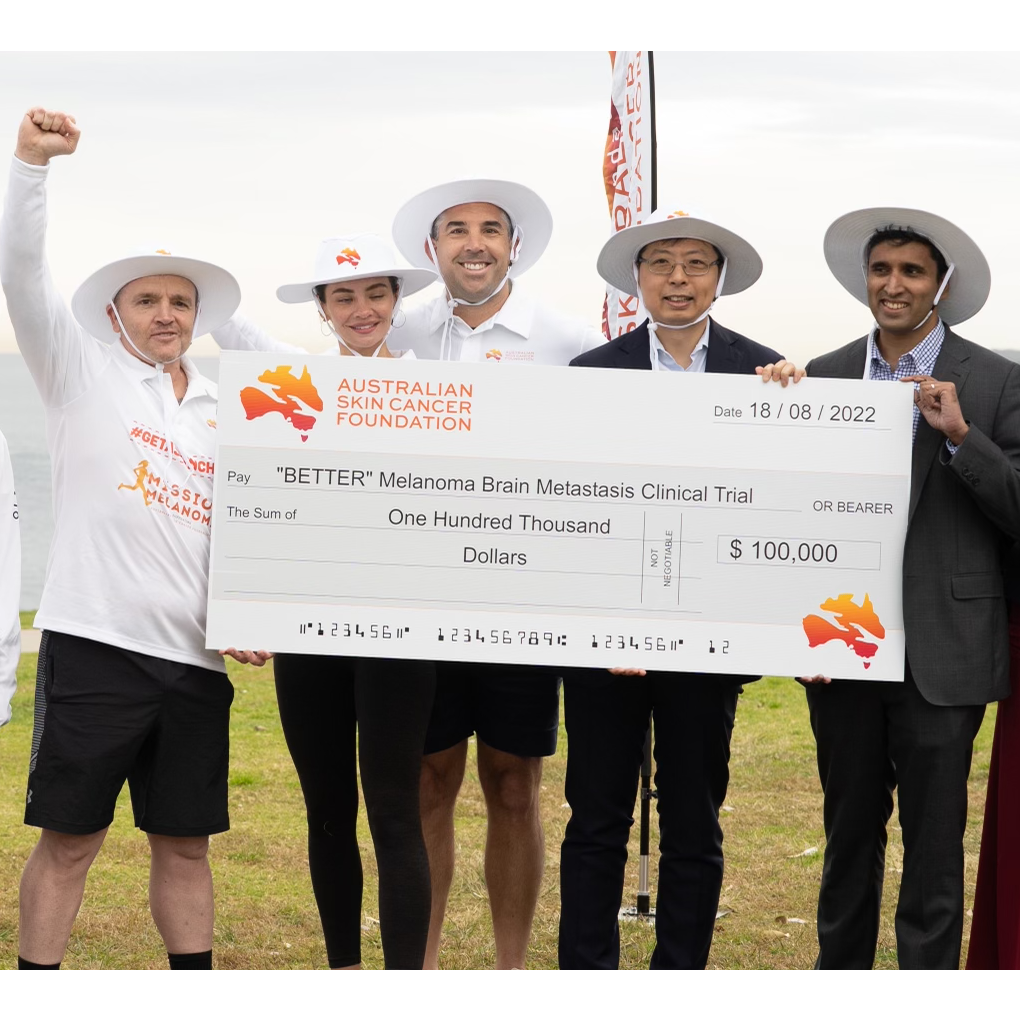 Walking fundraiser kick starts new melanoma trial￼