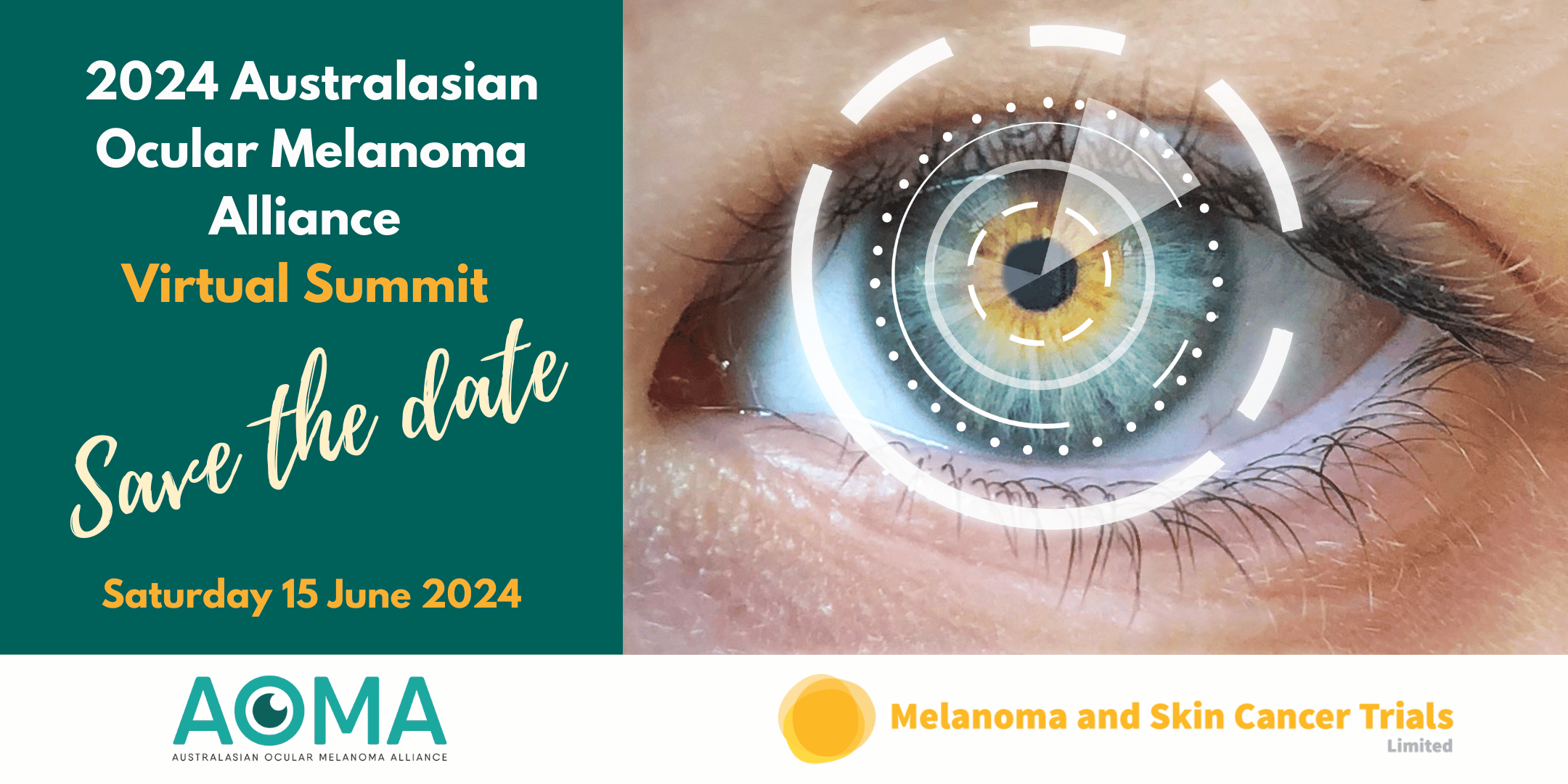 AOMA Summit 2023  Melanoma and Skin Cancer Trials